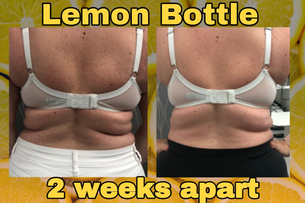Lemon Bottle Ampoule Solution for face and body 2 week before and after